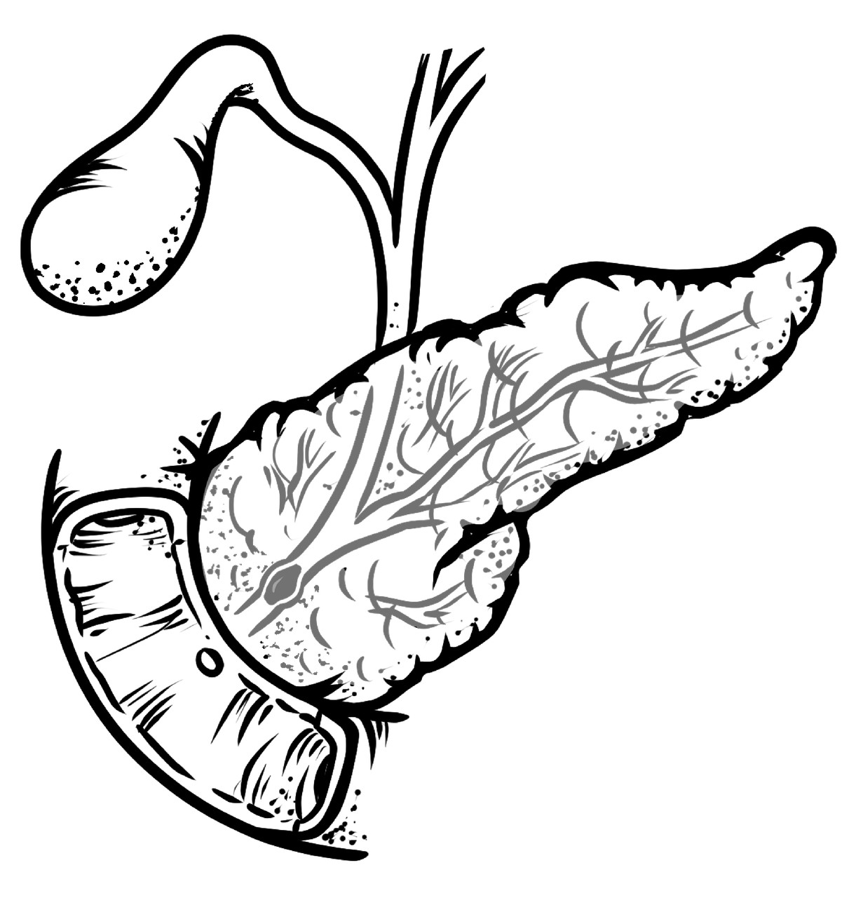 胆囊炎反复发作的原因