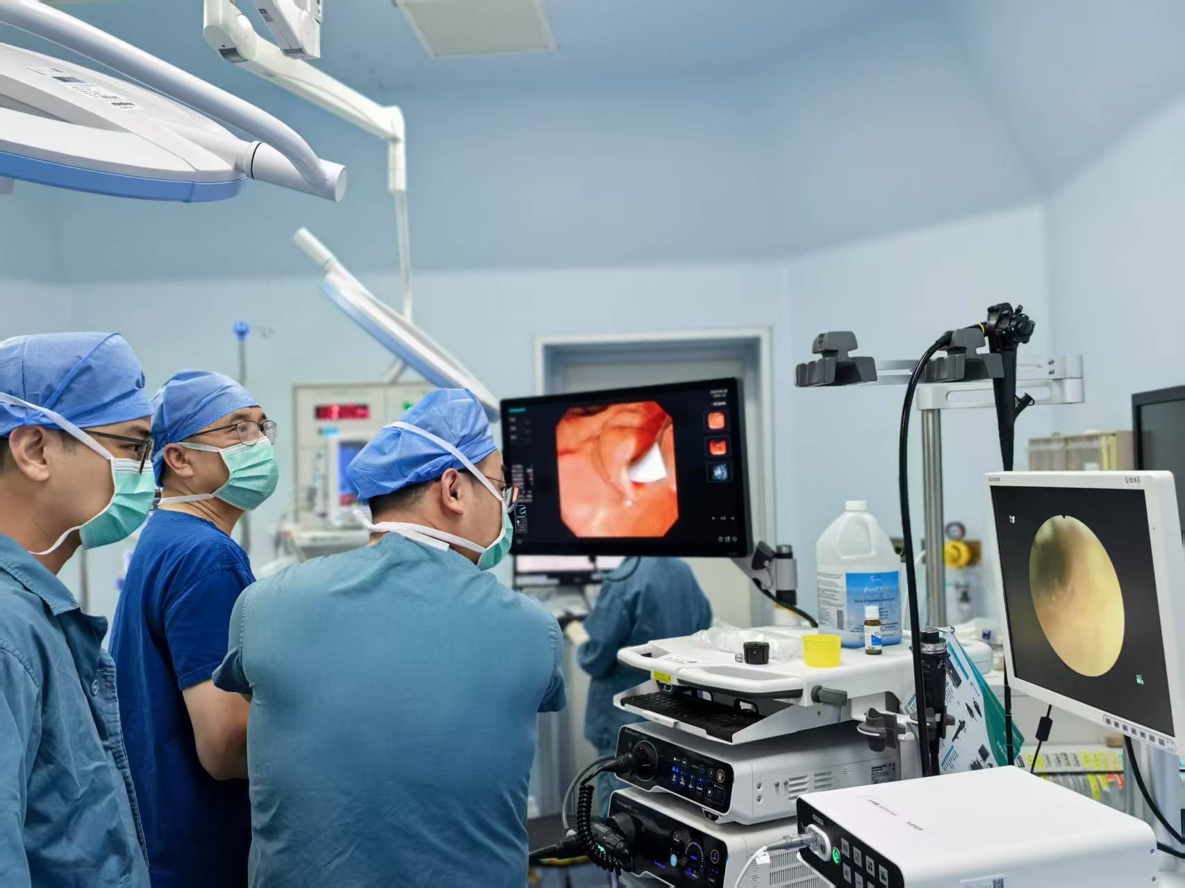 蔬果农药与胆囊健康